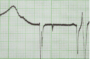 electrocardiogramaweb.jpg