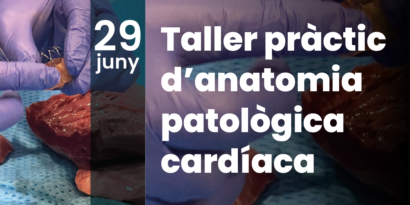 El Grup de Treball d’Infermeria Hemodinàmica organitza un taller pràctic d’anatomia patològica cardíaca