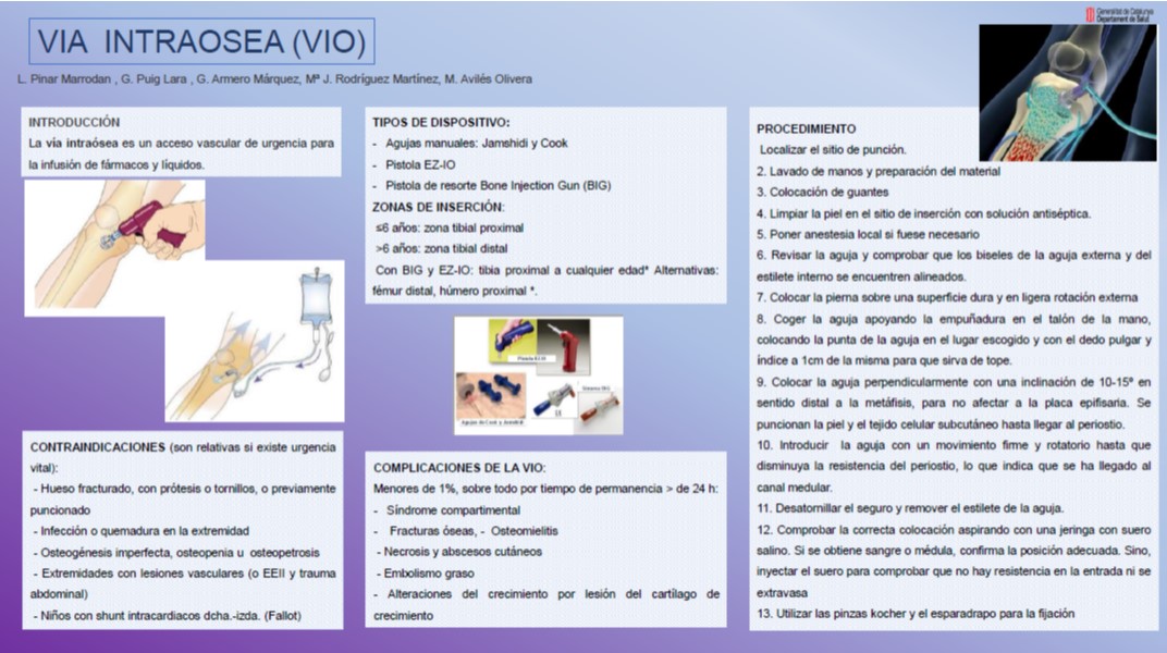 Pòsters Jornada